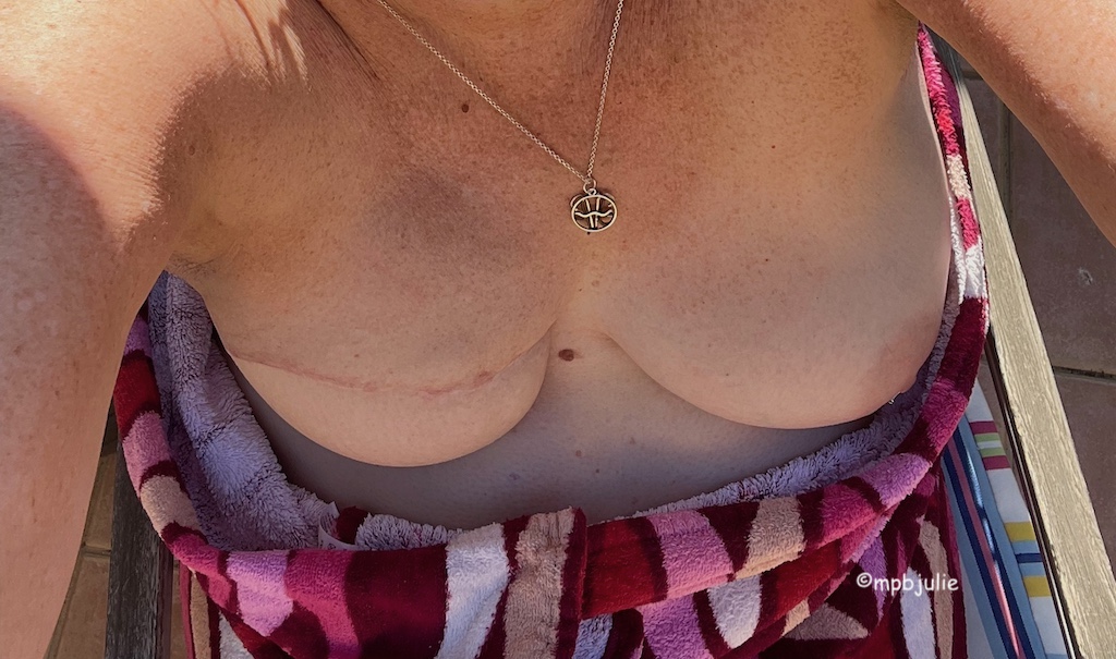 A cropped photo of me showing me sitting in a chair outside in the sun wrapped in a towel but showing my naked boobs 