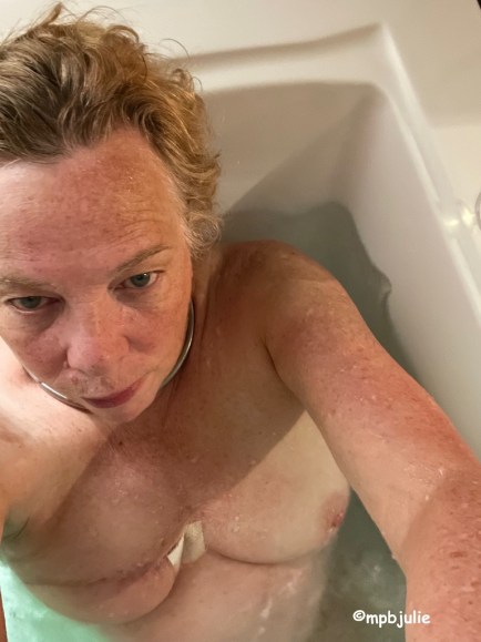 Me in a bath, it's a selfie so you can see my left arm but not right. The scar on my right breast reconstruction is visible as is the small dressing in my cleavage. 